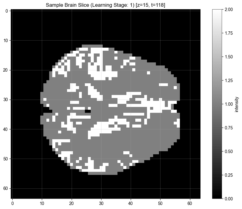 Example f MRI slice